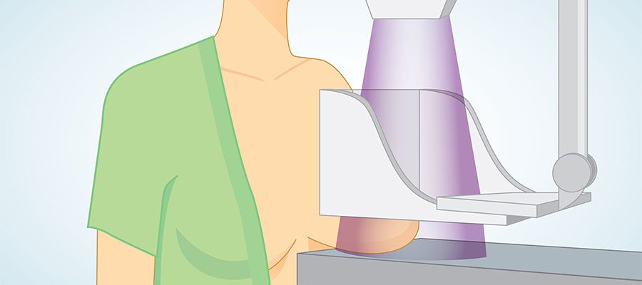 mamografia-rastreio