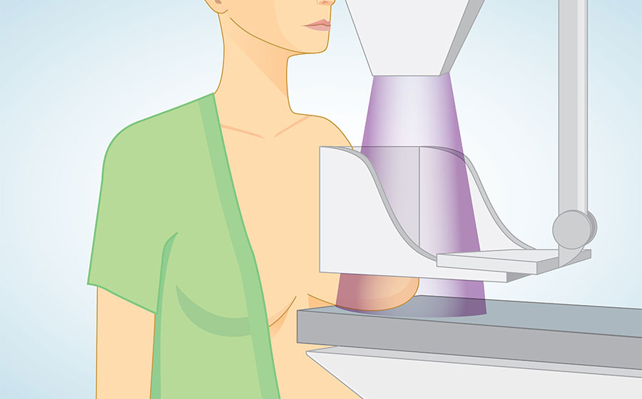 Rastreamento por mamografia e o diagnóstico de câncer de mama - Prof. Dr.  Silvio Bromberg