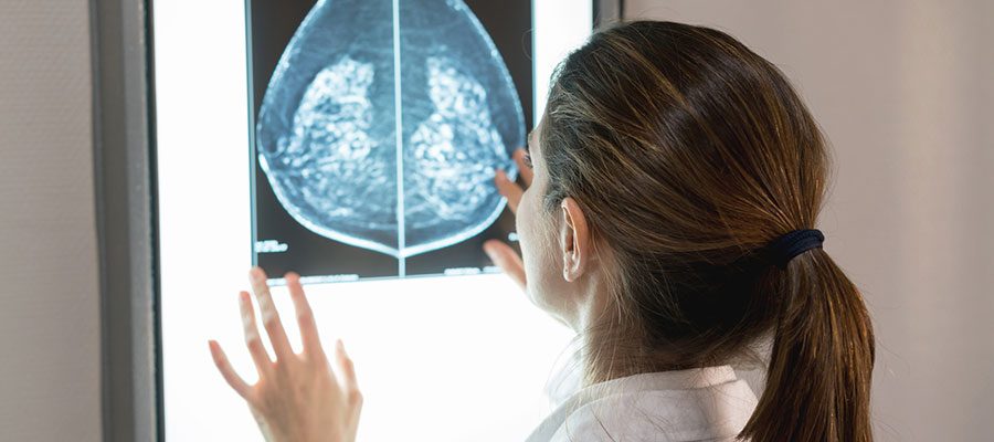 Médica analisando cisto no resultado de mamografia