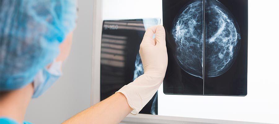 Analisando chapa de mamografia