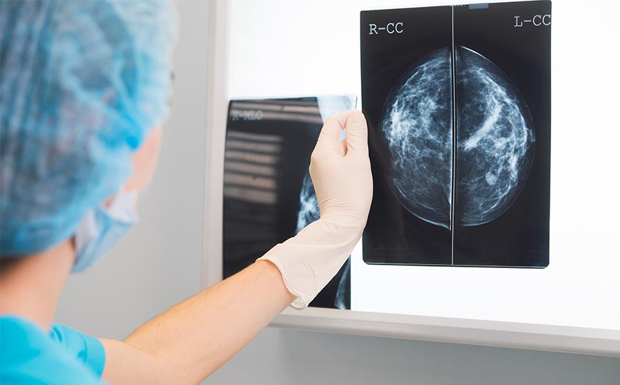Analisando chapa de mamografia