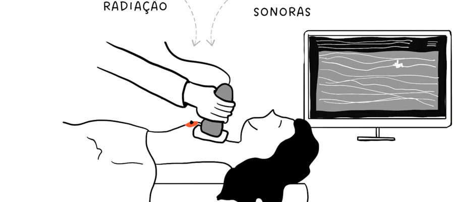 Ilustração de médica fazendo ultrassom nas mamas de paciente